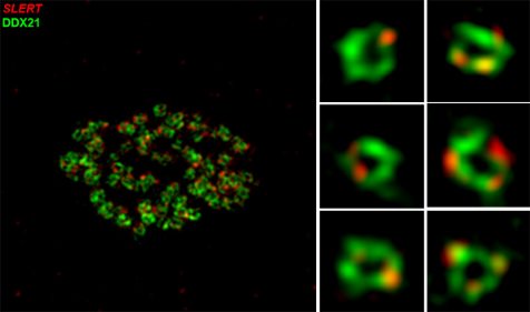 上海科学家发现新的长非编码 RNA，或成肿瘤治疗新靶点