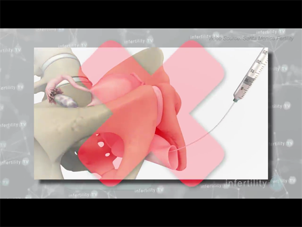 优质医疗资源紧张？试管绿通方案如何帮你锁定稀缺号源与床位优势