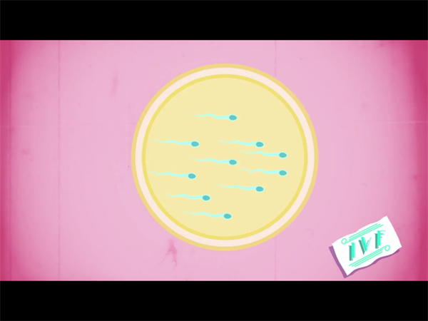 试管微刺激方案费用分析！性价比高但需关注隐藏成本