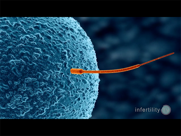 北医三院供精试管多次移植总费用会翻倍吗？省钱又高效的策略
