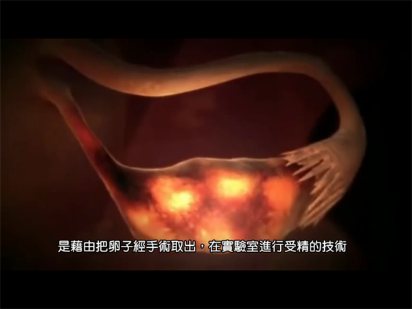 试管鲜胚移植全流程拆解！从取卵到着床的7个关键节点与避坑指南