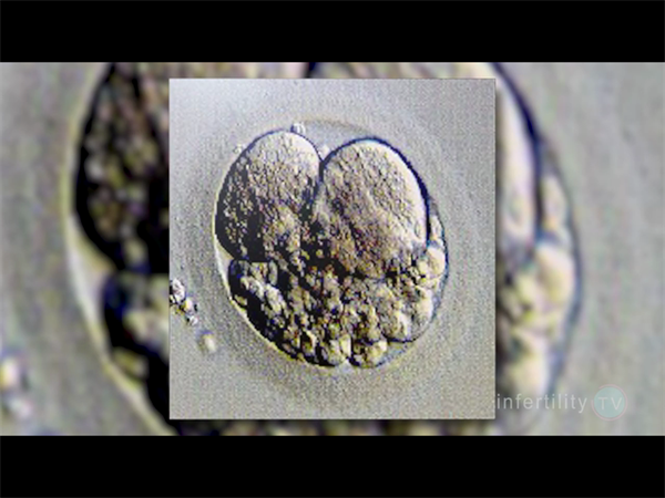 预算10万够吗?哈萨克斯坦试管助孕不同方案费用梯度全公开