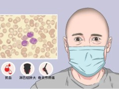 分析为什么会得白血病？如何护理白血病患者