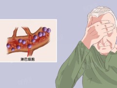 解读白血病的相关常识！附白血病出血的护理