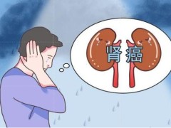 肾癌会诱发哪些并发症？了解诱因谨防肾癌的发生