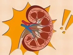 肾癌早期超声诊断！得了肾癌能生育吗