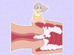 外阴炎的危害有哪些？外阴炎的诱发因素有哪些