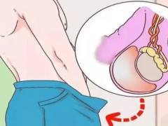 睾丸癌的具体危害是什么？附睾丸癌的护理方法
