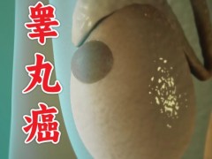 睾丸癌能治愈吗？治疗睾丸癌都有什么方法