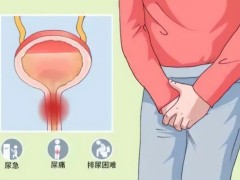 睾丸癌会传染吗？治疗睾丸癌的方法有哪些