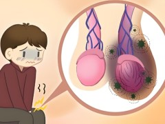睾丸癌的诊断包括什么？睾丸癌的病理是什么