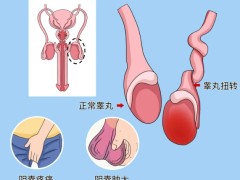 了解睾丸癌的分期！睾丸癌需要做什么检查