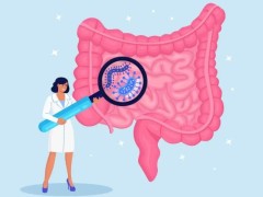 大肠癌患者可以怀孕吗？哪些人容易得大肠癌