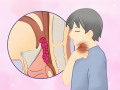 喉癌切除术后要怎么护理？手术护理从几个方面细说