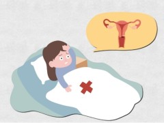 卵巢囊肿会传染给别人吗？如何才能避免发生卵巢囊肿