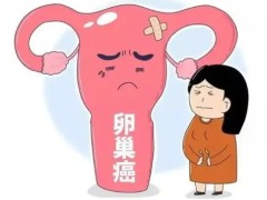 卵巢肿瘤的诊断方法有哪些？生活中卵巢肿瘤怎样护理