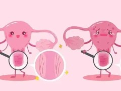 卵巢肿瘤不治疗危害大不大？孕期卵巢肿瘤会再次发作吗