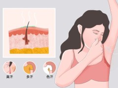 汗腺癌是怎样的一种癌症？汗腺癌能存活多长时间
