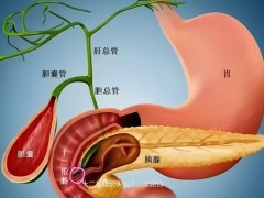 所有胆囊癌都遗传吗？胆囊癌发热的危害是什么