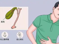 饮食与胆囊癌的关系！附胆囊癌的病理分型