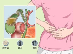 胆囊癌的检查方法主要包括哪些？患胆囊癌影响受孕吗