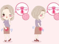 宫颈癌传染性伴侣吗？宫颈癌术后怎么保养