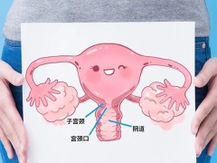 得了宫颈癌用什么药？宫颈癌几期最严重