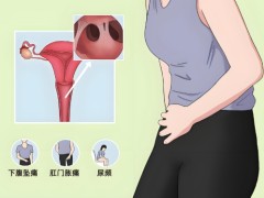日常存在的一些宫颈癌的发病原因！专家对宫颈癌的几点原因分析