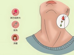 淋巴癌早期能治愈么？可以预防淋巴的食物有哪些