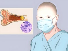 得了淋巴癌怎么治疗？淋巴癌的危害大不大
