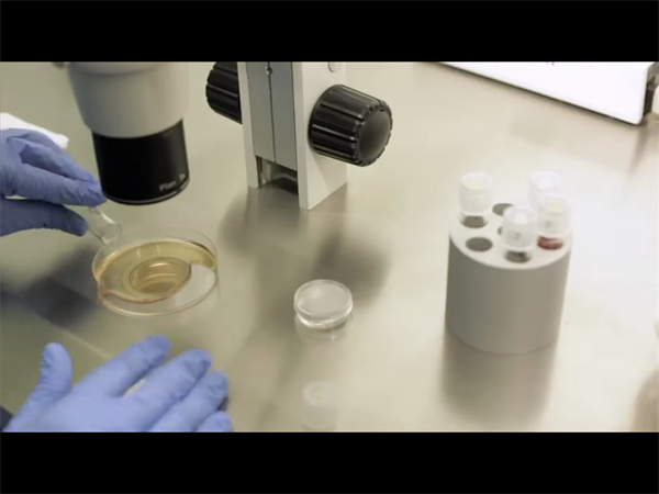 供卵者筛选标准会影响试管费用吗?优质卵源与成本的关联分析